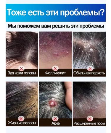 LYDIMOON Significant shampoo against dandruff 300 ml - Buy Online on GoSupps.com