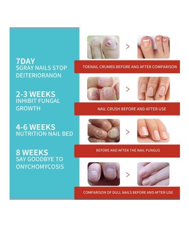 16 pcs patch to restore nails without glue fixed - Buy Online on GoSupps.com