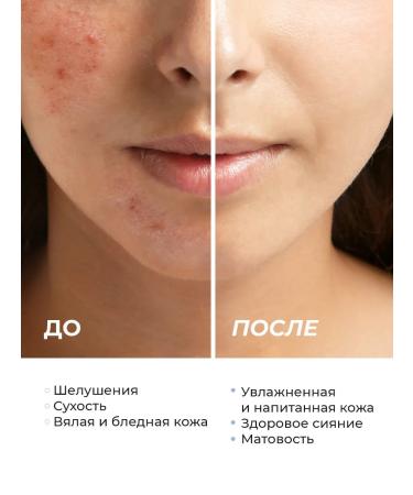 Seauty Cream for face and hands moisturizing nutritious with cramids - Buy Online on GoSupps.com