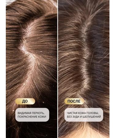 ShampoosBench Hard hair shampoo from dandruff