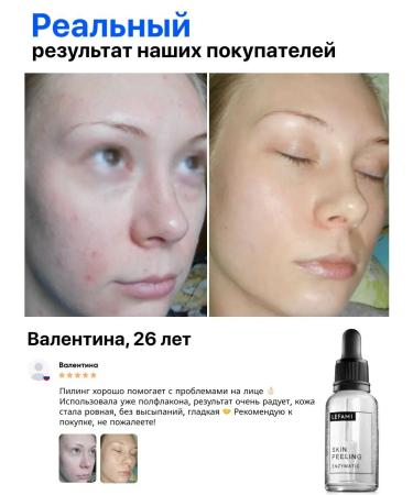 PeelingOnline Facial peeling - Buy Online on GoSupps.com