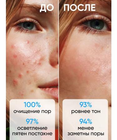 PeelingOnline Facial peeling - Buy Online on GoSupps.com