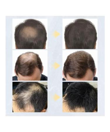 ThickenersBox Thickener for hair and beard powder