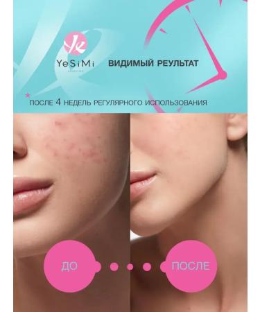 PeelingOnline Set 2B1 Piling Skatka+Foam Anti-Akne - Buy Online on GoSupps.com