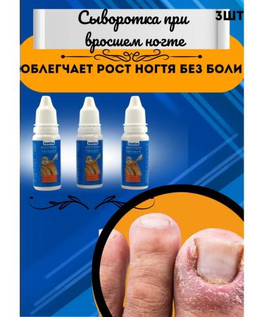 ARUUM Caring for an ingrown fingernail without pain