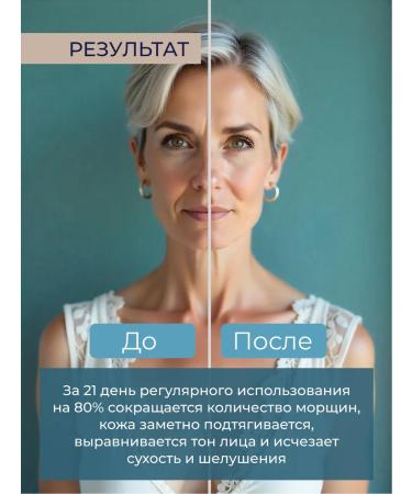 Isntree Facial serum anti -aging with bifidobacteria 50 ml - Buy Online on GoSupps.com