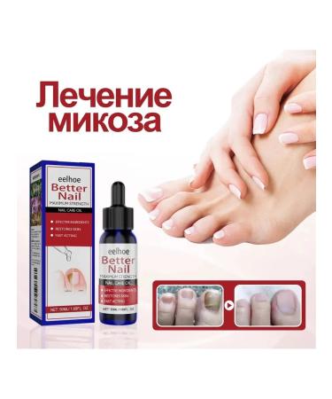 eelhoe moisturizes the restoration of nails to suppress fungi liquid - Buy Online on GoSupps.com