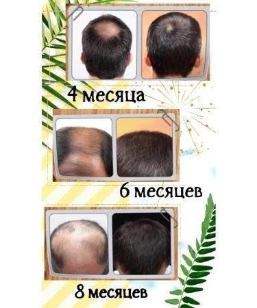 SerumDepot Hair loss and hair loss - Buy Online on GoSupps.com