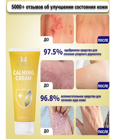 Ointment from psoriasis from eczema from dermatystabystro and effectively - Buy Online on GoSupps.com