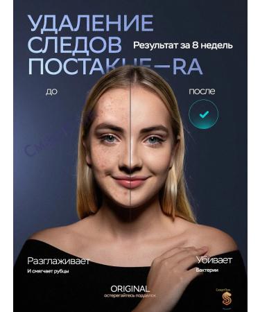 3v1 laser epilator power 15-20 j - Buy Online on GoSupps.com