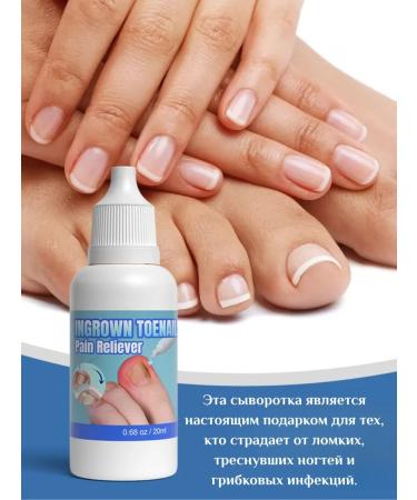 Antibacterial fluid for the treatment of ingrown nails 5 pcs - Buy Online on GoSupps.com