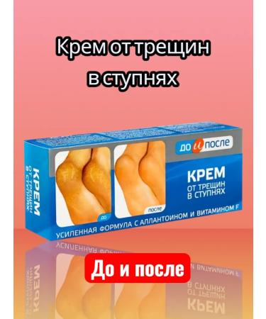 Feet cream from cracks in the feet