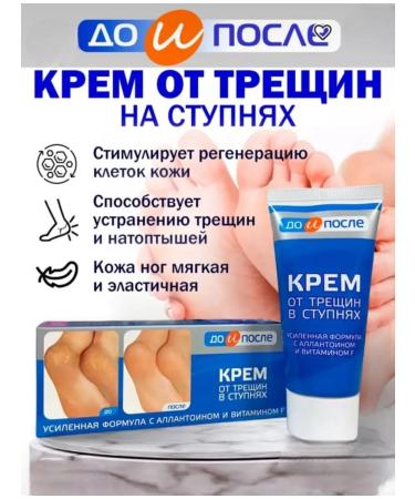 Feet cream from cracks in the feet - Buy Online on GoSupps.com