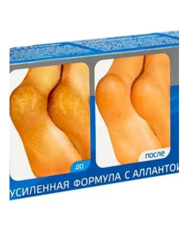 Feet cream from cracks in the feet - Buy Online on GoSupps.com