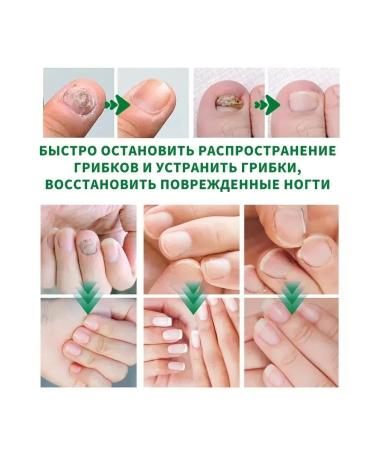 Nail care tool from nail fungus - Buy Online on GoSupps.com