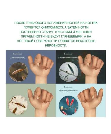 Nail care tool from nail fungus - Buy Online on GoSupps.com