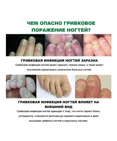 Nail care tool from nail fungus - Buy Online on GoSupps.com