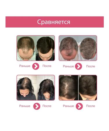 Ouhoe Repair hair care of essential oil is not bifurcated aromat - Buy Online on GoSupps.com