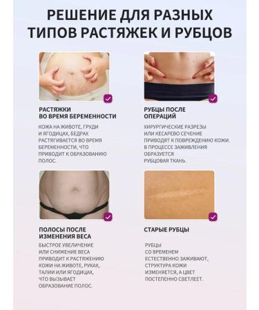 Cream from stretch marks and scars after giving birth 20 g - Buy Online on GoSupps.com