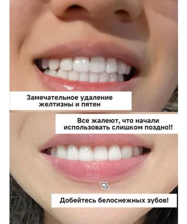 V34 Violet bleaching toothpaste 30 ml - Buy Online on GoSupps.com