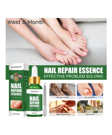 West & Month Nail Recovery Solution - Buy Online on GoSupps.com