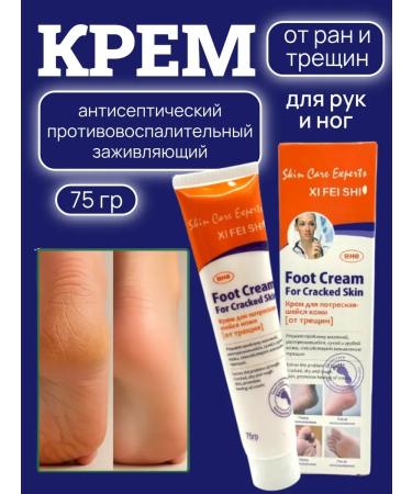 MIX accessories Cream from cracks on heels healing