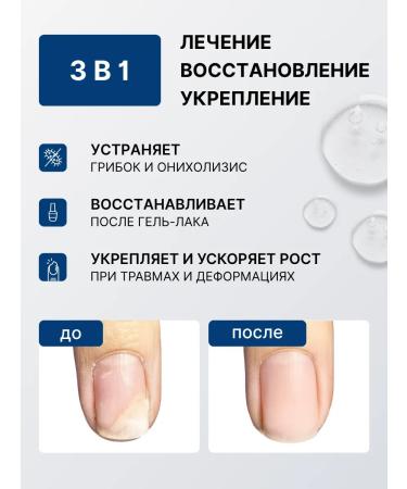 Nail nail serum and onycholysis of the spirularin ns - Buy Online on GoSupps.com