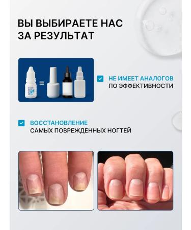 Nail nail serum and onycholysis of the spirularin ns - Buy Online on GoSupps.com