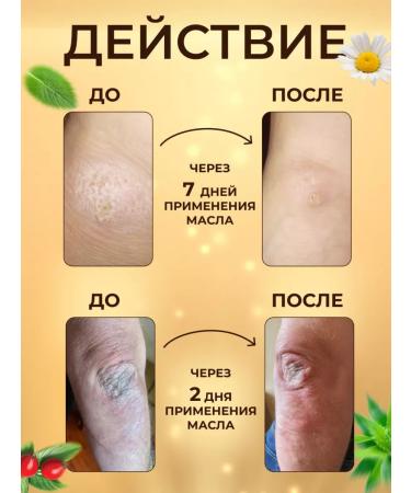 IPURITY Therapeutic body cream - Buy Online on GoSupps.com