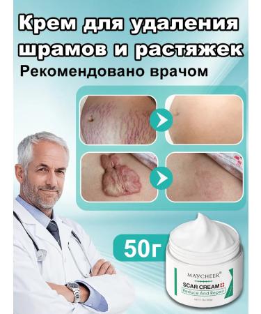 Cream from scars and stretch marks 50 g any part of the body