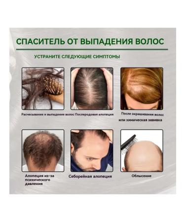 eelhoe Reduce loss of hair with a capsule capsule nourishes the hair - Buy Online on GoSupps.com