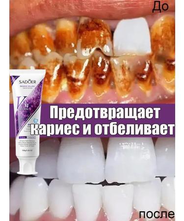Toothpaste whitening from bleeding and caries