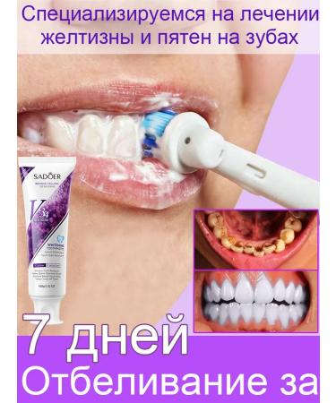 Toothpaste whitening from bleeding and caries - Buy Online on GoSupps.com