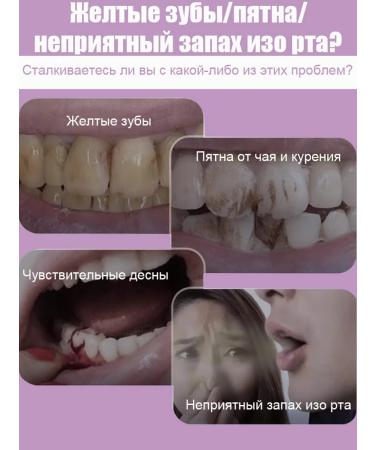 Toothpaste whitening from bleeding and caries - Buy Online on GoSupps.com