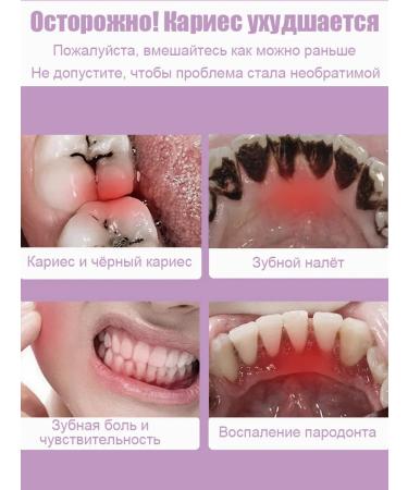 Toothpaste whitening from bleeding and caries - Buy Online on GoSupps.com
