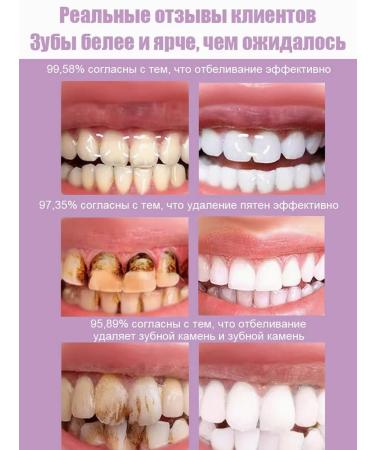 Toothpaste whitening from bleeding and caries - Buy Online on GoSupps.com