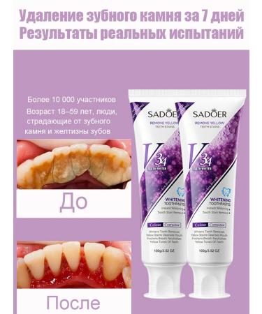 Toothpaste whitening from bleeding and caries - Buy Online on GoSupps.com