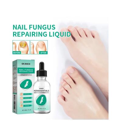 Ouhoe nail care solution