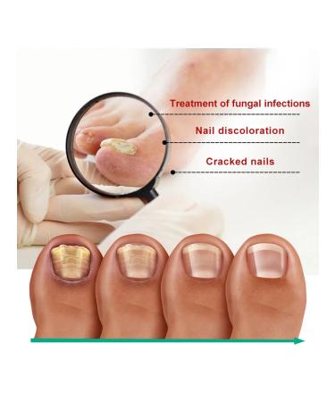 Ouhoe nail care solution - Buy Online on GoSupps.com