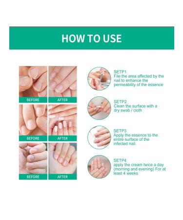 Ouhoe nail care solution - Buy Online on GoSupps.com