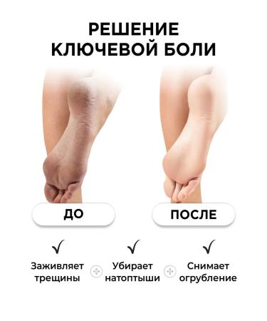 BLOOMERA Moisturizing legs arms heels with urea 20% - Buy Online on GoSupps.com