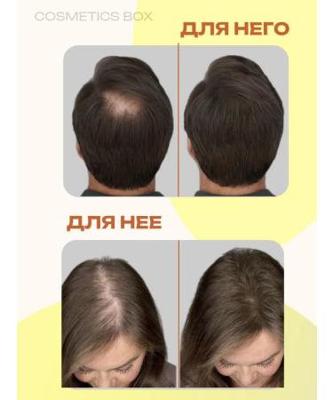Cosmetics box Hair growth oil - Buy Online on GoSupps.com