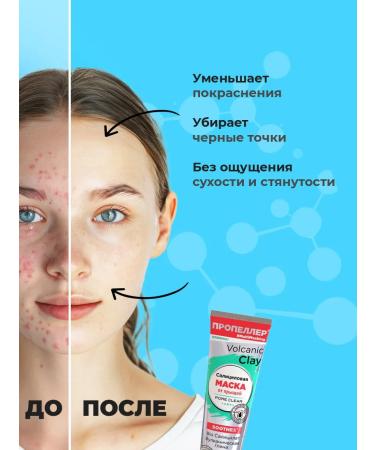 PROPELLER A set of face masks from acne and black dots 40 ml*3pcs - Buy Online on GoSupps.com