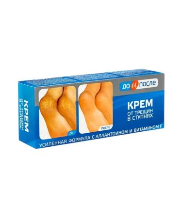 BEFORE AND AFTER Cream from cracks in the feet 50ml