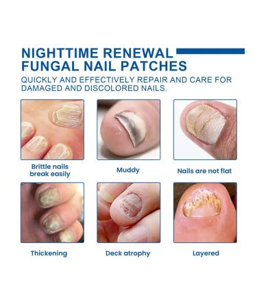 Night patch for nail care Ximonth - Buy Online on GoSupps.com