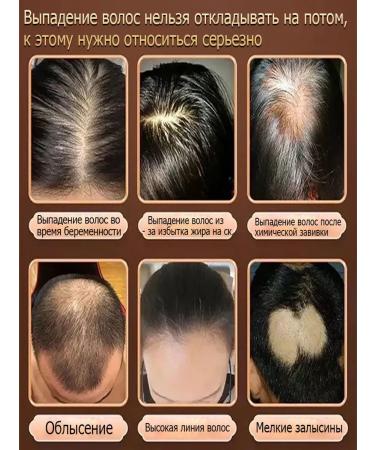 Professional Hair growth Dodoyuri - Buy Online on GoSupps.com