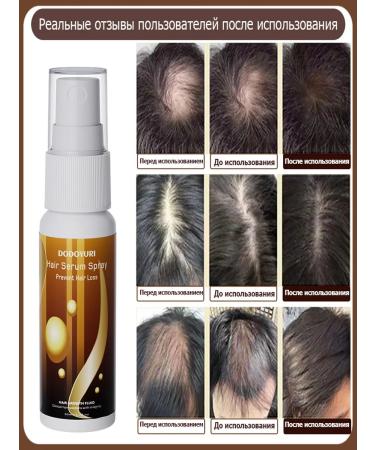 Professional Hair growth Dodoyuri - Buy Online on GoSupps.com
