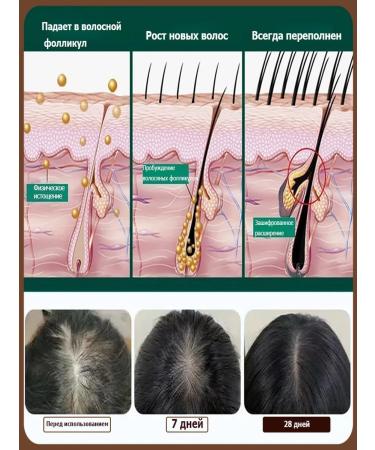 Professional Hair growth Dodoyuri - Buy Online on GoSupps.com
