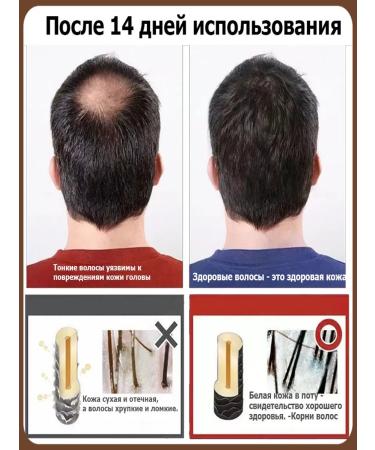 Professional Hair growth Dodoyuri - Buy Online on GoSupps.com
