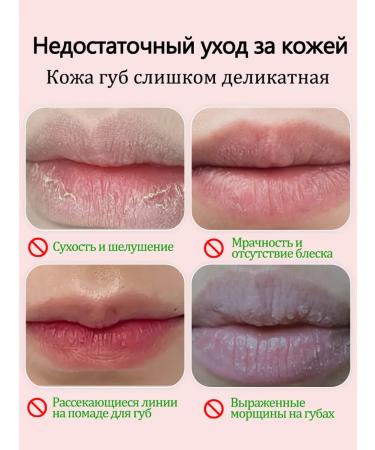 Lip balm moisturizing recovery - Buy Online on GoSupps.com